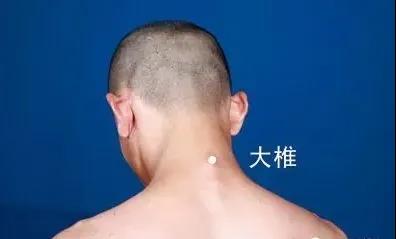 春天灸灸背，能活一百歲~