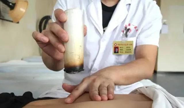 產(chǎn)后艾灸一個(gè)月，十年少生?。?