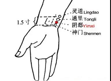 睡覺愛出汗，艾灸這幾個(gè)穴位
